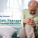 Stem Cell Therapy for Knee Osteoarthritis