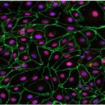 Advantages and Disadvantages of Primary Cells